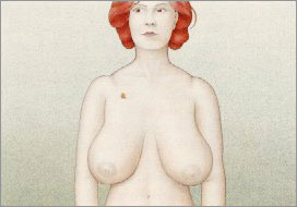 breast bursa, meme estetiği bursa, göğüs estetiği bursa
